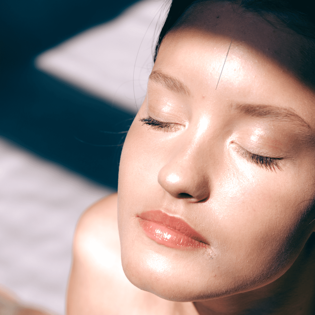 Lady with closed eyes with acupuncture needle in forehead